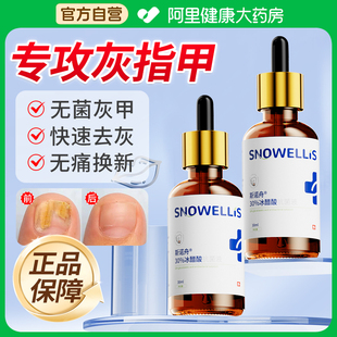 30%冰醋酸涂剂外用抗菌抑菌液冰乙酸灰泡脚甲变硬正品溶液真菌