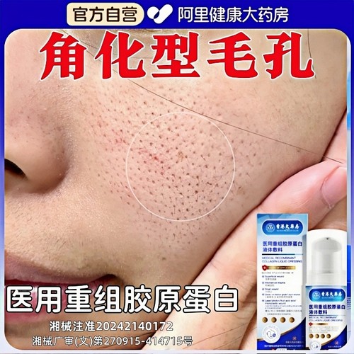 痘印痘坑术后修复收缩毛孔粗大闭口角质医用重组胶原蛋白敷料正品