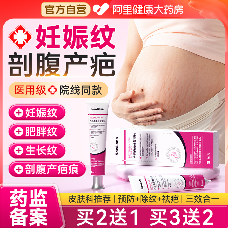 妊娠纹产后消除祛疤膏贴剖腹产疤痕增生去除肥胖纹修复霜硅酮凝胶