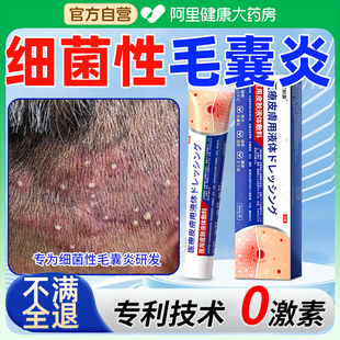 细菌性毛囊炎头皮毛囊炎特效专用除螨头皮清洁止痒头部头皮长痘痘