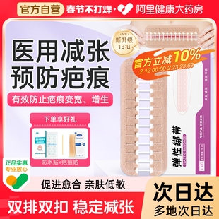 医用拉链式减张器甲状腺剖腹产减张贴术后伤口愈合免缝疤痕减张