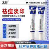 太田日本太田天然芦荟壬二酸凝胶去痘膏消闭口晒后修复肌肤30g