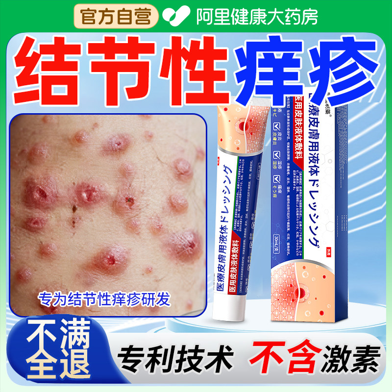 结节性痒疹皮肤湿疹治顽固硬疙瘩药膏皮肤痒药严重止痒皮炎瘙痒