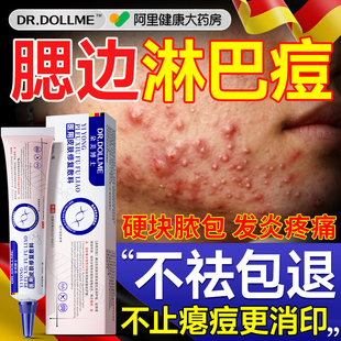 腮边淋巴痘专用痘膏祛下巴反复长暗痤疮红肿硬块消炎闭口粉刺药房