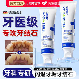 去牙结石专用牙膏速溶解牙石效清理美白去黄牙烟渍口臭除异味神器