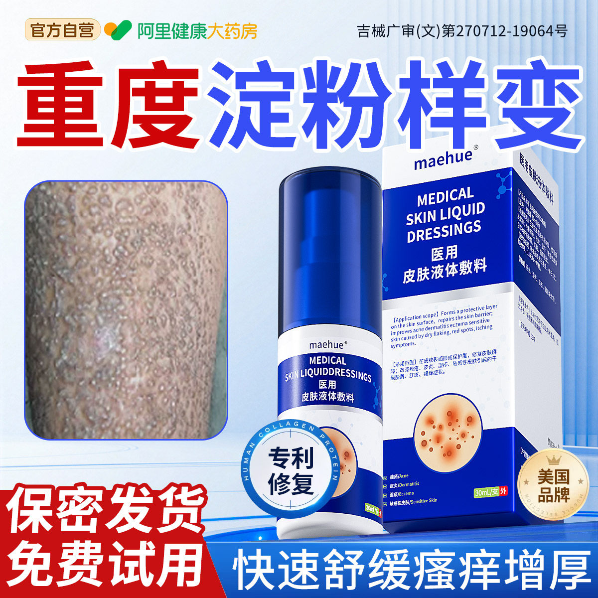 皮肤淀粉样变皮藓胳膊小腿顽固后背黑色素疙瘩止痒膏瘙痒克星止痒