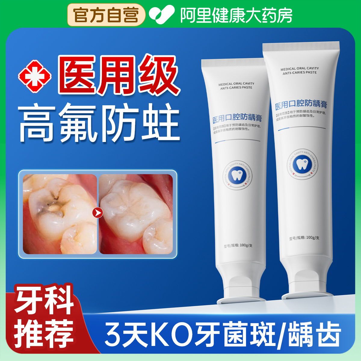 牙膏防蛀抗敏含氟成人蛀牙专用牙洞清理去黄去口臭美白官方旗舰店