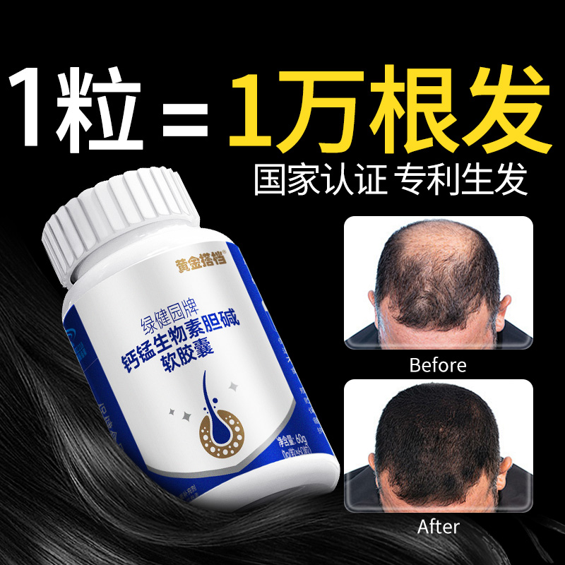 维生素防脱发生发生物素hb7复合b族胶囊掉发严重吃什么非叶酸正品