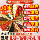 赤小红豆薏米茯苓茶炒熟五指毛桃祛排湿气去除湿寒气毒芡实养生茶