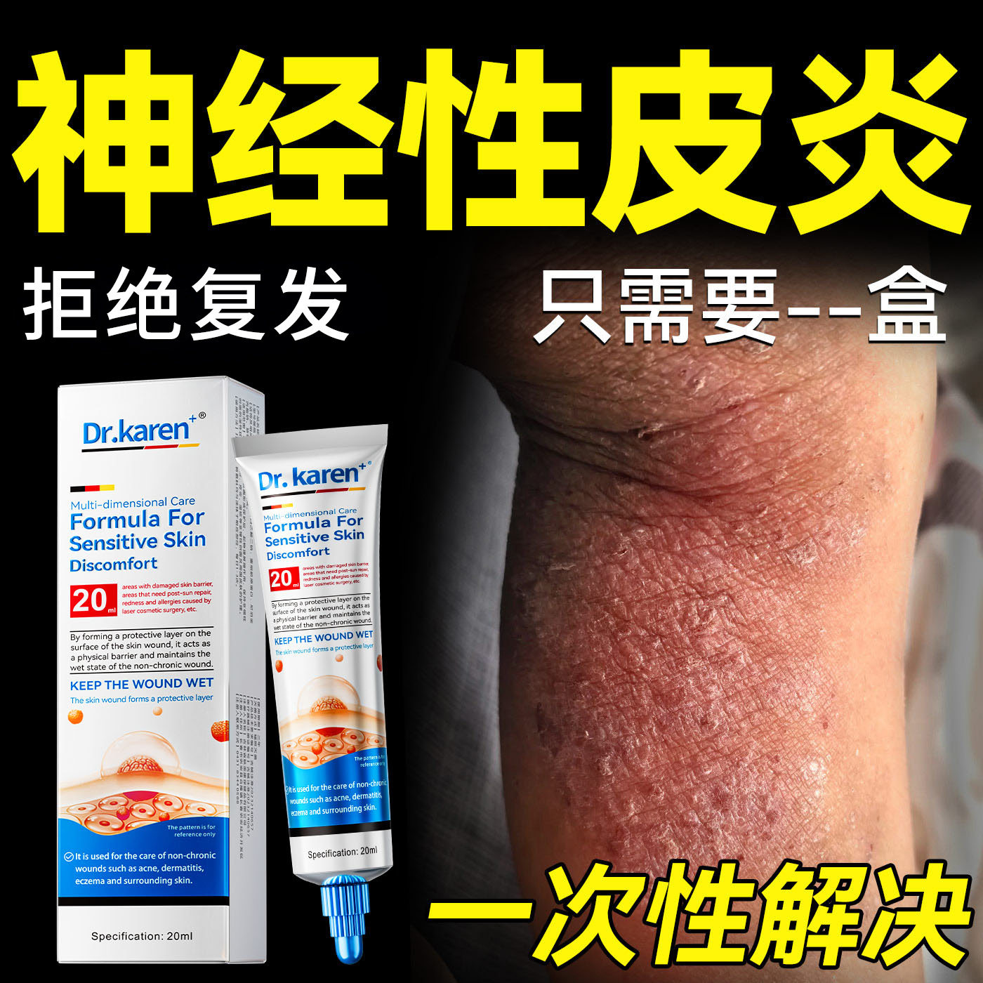 神经性皮炎特去除效外用药膏顽固根无激素除皮肤痒止真菌感染治疗