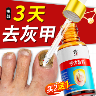 修正医用灰指甲专用抑菌液甲沟炎甲变厚发黄冰醋酸正品 官方旗舰店