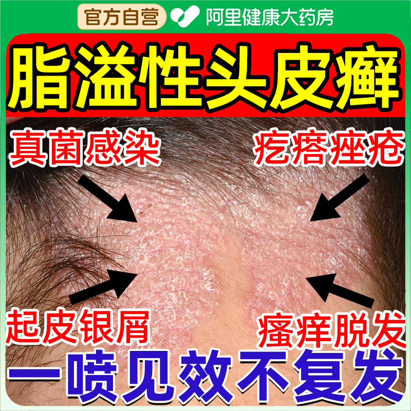 头痒止痒毛囊炎去屑红疹抑菌脓包结痂皮肤痒