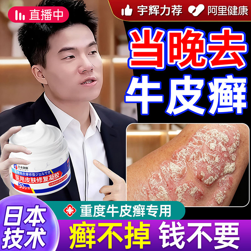 顽固牛皮癣银屑病专用膏日本特皮肤癣治皮肤瘙痒外用止效痒抑菌疗