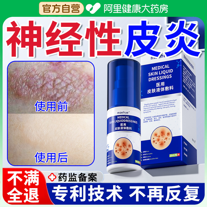 【效果NO.I】神经性皮炎不反复