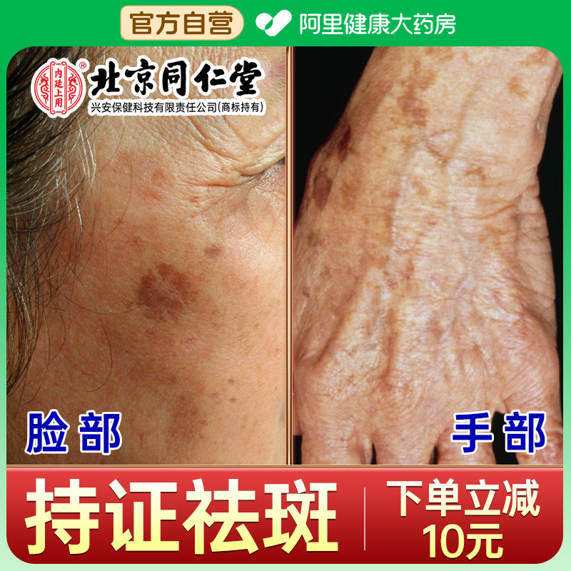 美白祛斑霜黄褐斑老年斑强力去除脸部手部背上黑斑专用正品旗舰店