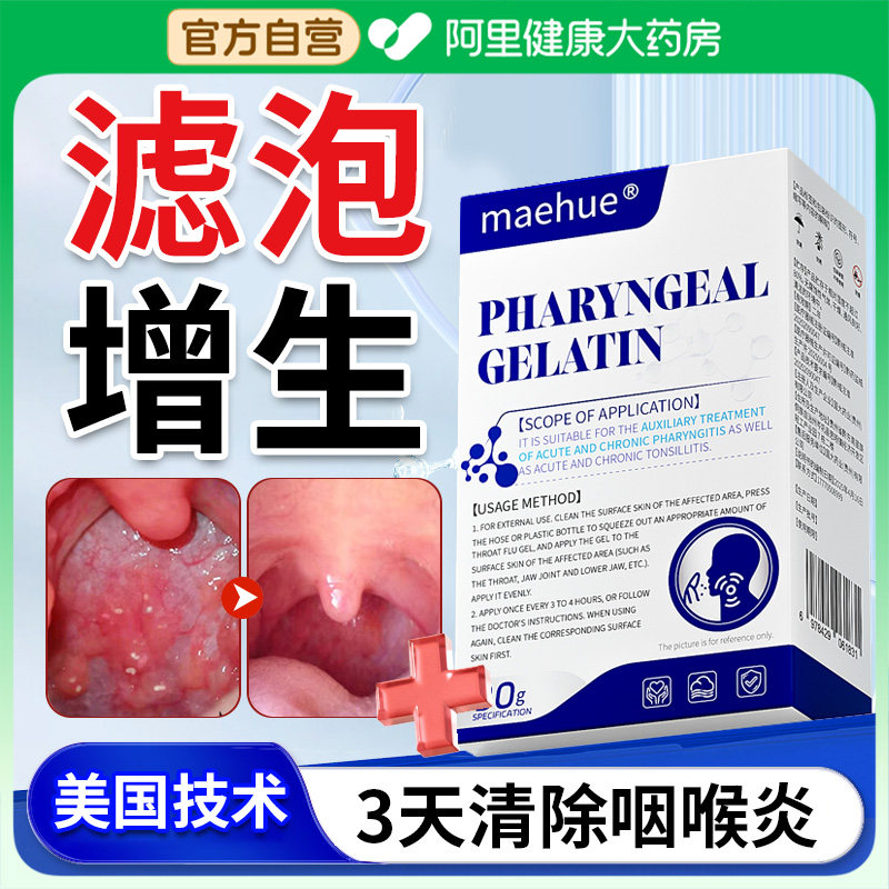 滤泡增生慢性咽炎喉咙滤泡增生嗓子咽喉有痰慢性咽喉炎异物感喷雾