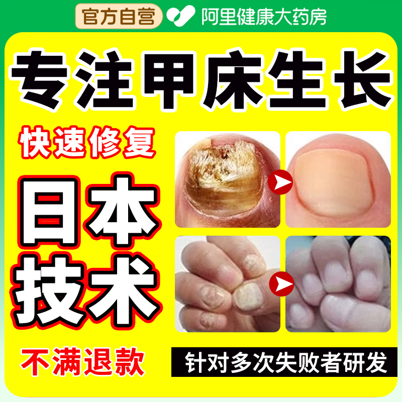 甲床分离空甲分层专用灰指甲修复受损再生护甲受损游离线生长液