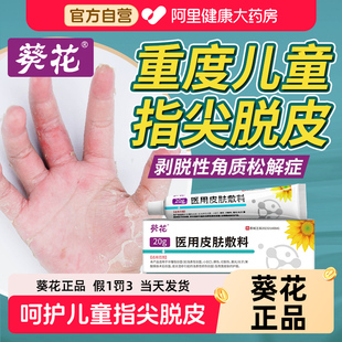 葵花儿童手指脱皮干裂真菌感染严重剥脱性角质松懈症小孩手足皲裂