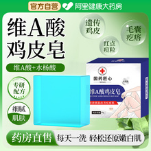 去鸡皮肤疙瘩毛囊角化角质维A酸鸡皮皂除螨止痒洗澡手工香皂正品