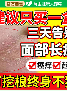 嘴角下巴脸上长癣干燥起皮红痒溢脂性皮炎面部有碎屑泛红皮肤过敏