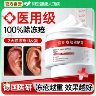 医用冻疮膏止痒冻伤膏耳朵消肿儿童防冻防裂正品特效修复护手足霜