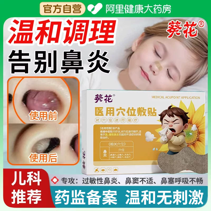 儿童治鼻塞通鼻专用鼻窦炎鼻贴疗神器贴根鼻炎膏药中药医用穴位