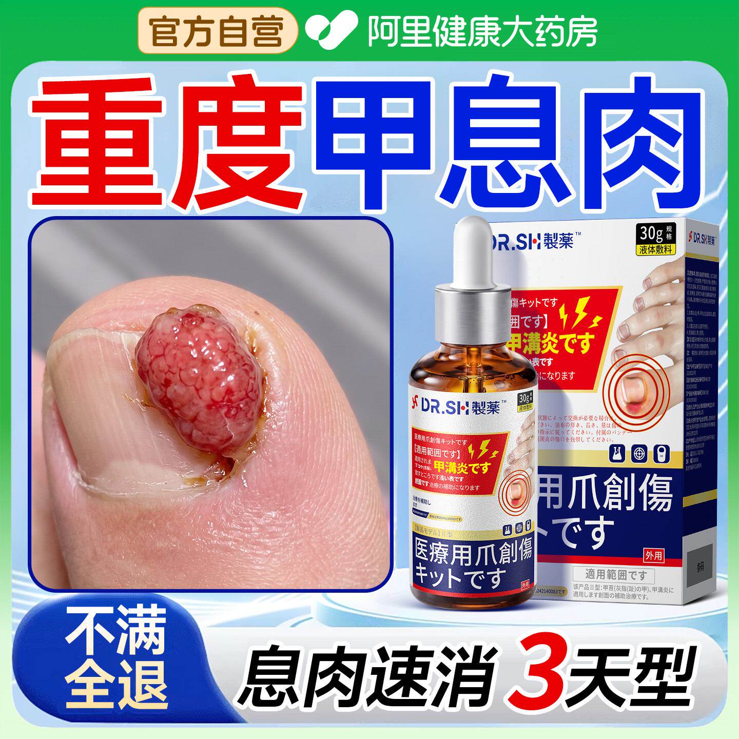 甲沟炎息肉脱落神器冶嵌甲去肉芽消肿除专疗用特指甲效矫正器药房