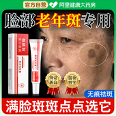 脸上老年斑强力去除脸部手部去斑专用美白祛斑霜手背上祛老年斑