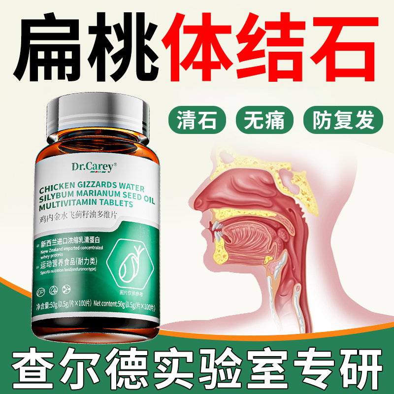 扁桃体结石去除药喉咙结石发炎咽喉肿痛神器隐窝口腔喷剂排石特效