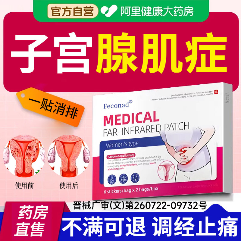 女性专特子宫腺肌症治宫寒痛经内膜异位肿块增用肌瘤药贴效疗中大