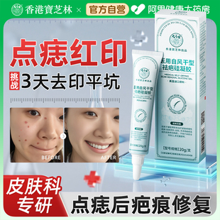 脸上点痣后去红印疤痕修复激光祛痣修复液除疤祛疤膏凹陷疤痕专用