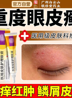 眼皮癣红肿眼睛周围痒过敏发痒眼膏止痒眼角里面干燥起神经性皮炎