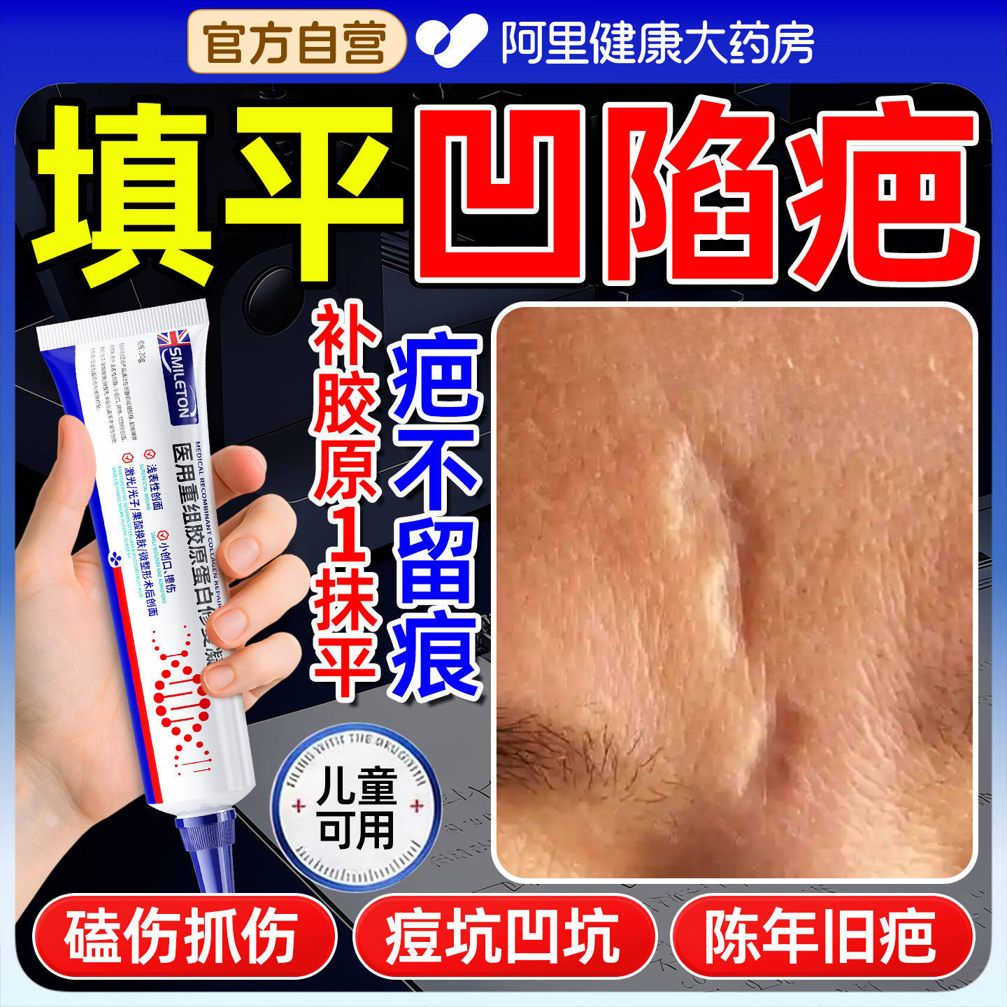 凹陷性疤痕修复除疤膏生长因子痘坑凹洞医用重组胶原蛋白凝胶填充