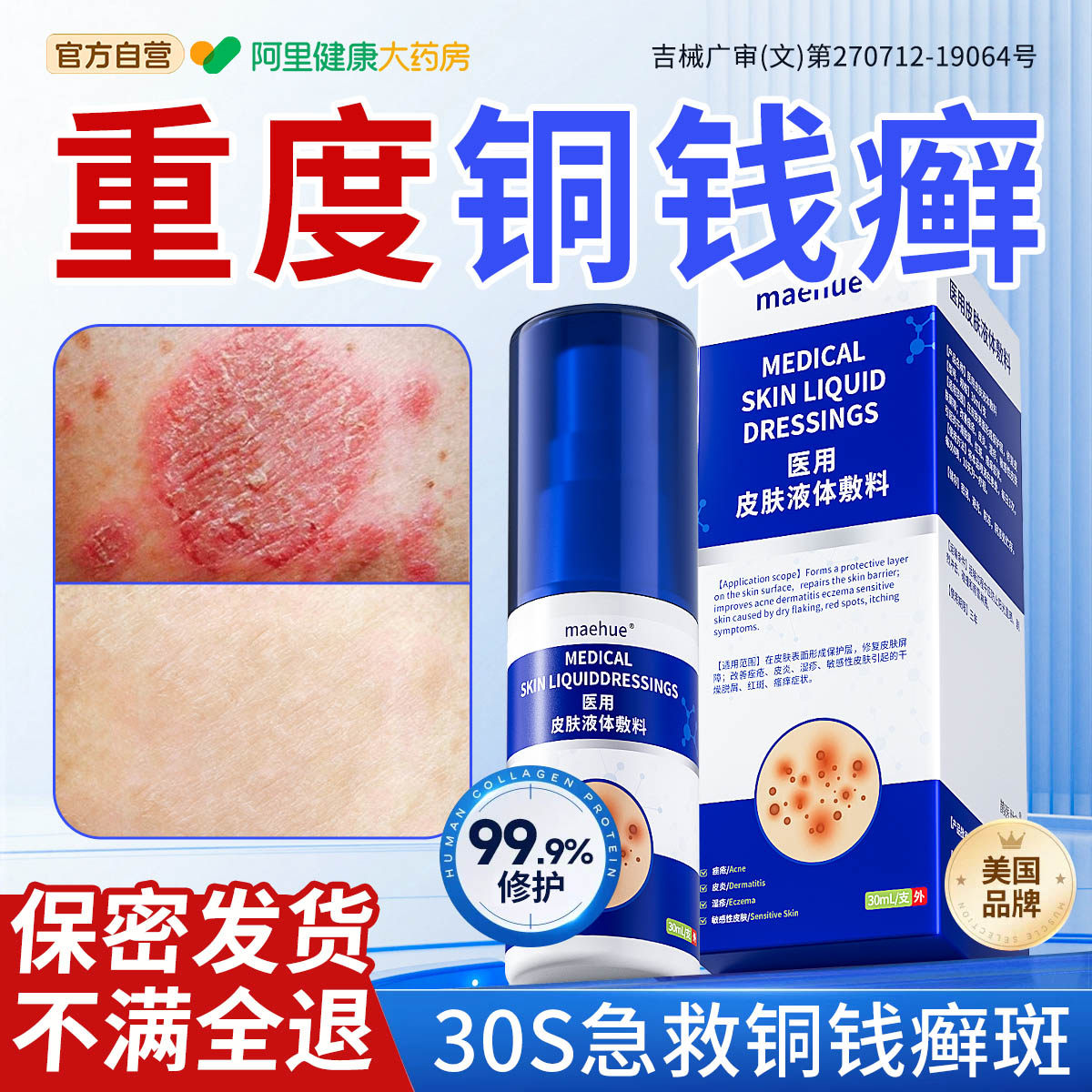 铜钱癣体癣皮癣真菌感染去外用皮肤杀菌止痒股藓顽固专用膏皮肤癣