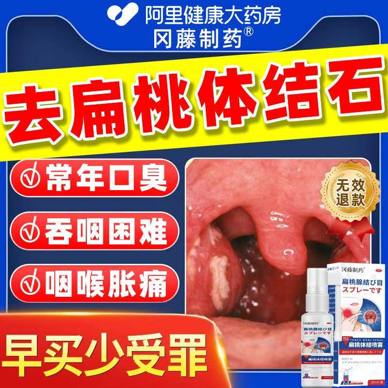 扁桃体结石去除工具漱口水喷剂清理口腔口臭隐窝冲洗器神器非电动