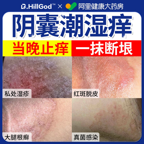阴囊湿疹止痒男性私处睾丸出汗潮湿癣瘙痒大腿根内侧皮肤股藓用膏