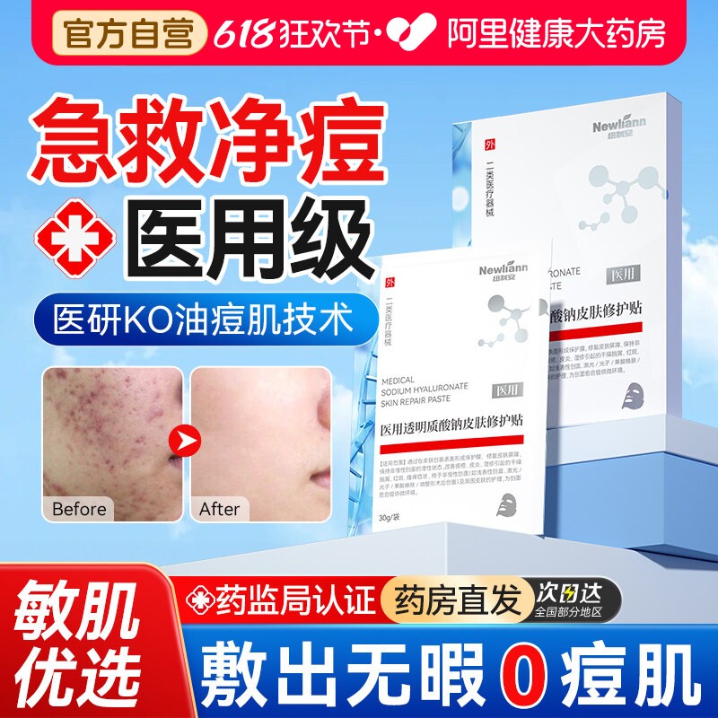 医用冷敷贴去痘淡化痘印收缩毛孔控油消炎痤疮净痘女男士非面膜型