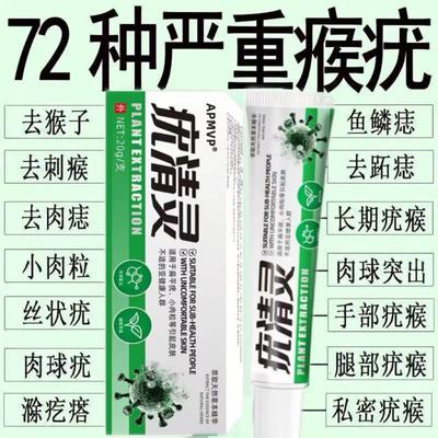 扁平疣丝状尤脖子上长小肉粒瘊子一抹去灵疣非药膏去除神器疣清宁