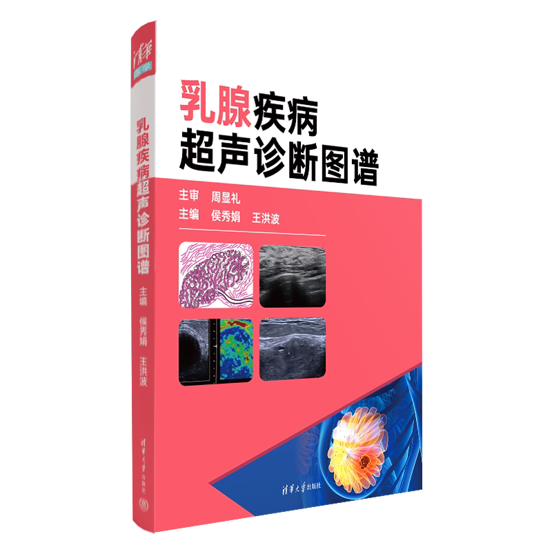 乳腺疾病超声诊断图谱清华大学