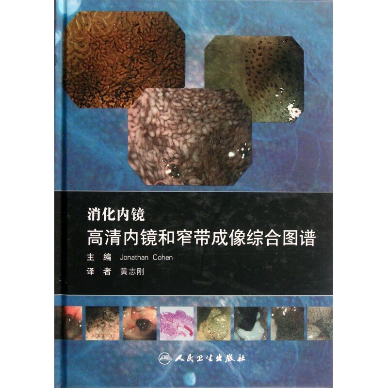 消化内镜高清内镜和窄带成像综合图谱(附光盘)(精)