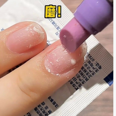 指甲营养油指甲边缘油美甲精华笔去死皮倒刺指甲指缘滋养护手精油