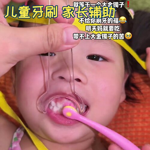 儿童牙刷宝宝刷牙神器!口腔开口器辅助扩充器牙齿污垢清洁小工具!