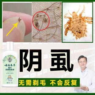 云南本草复方百部酊香波阴虱沐浴露虱子药虱立净去除虱一扫光正品