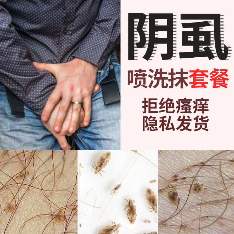 阴虱专用药虱立净阴虱虫卵双杀虱子药狮子药水云南本草虱立净特效