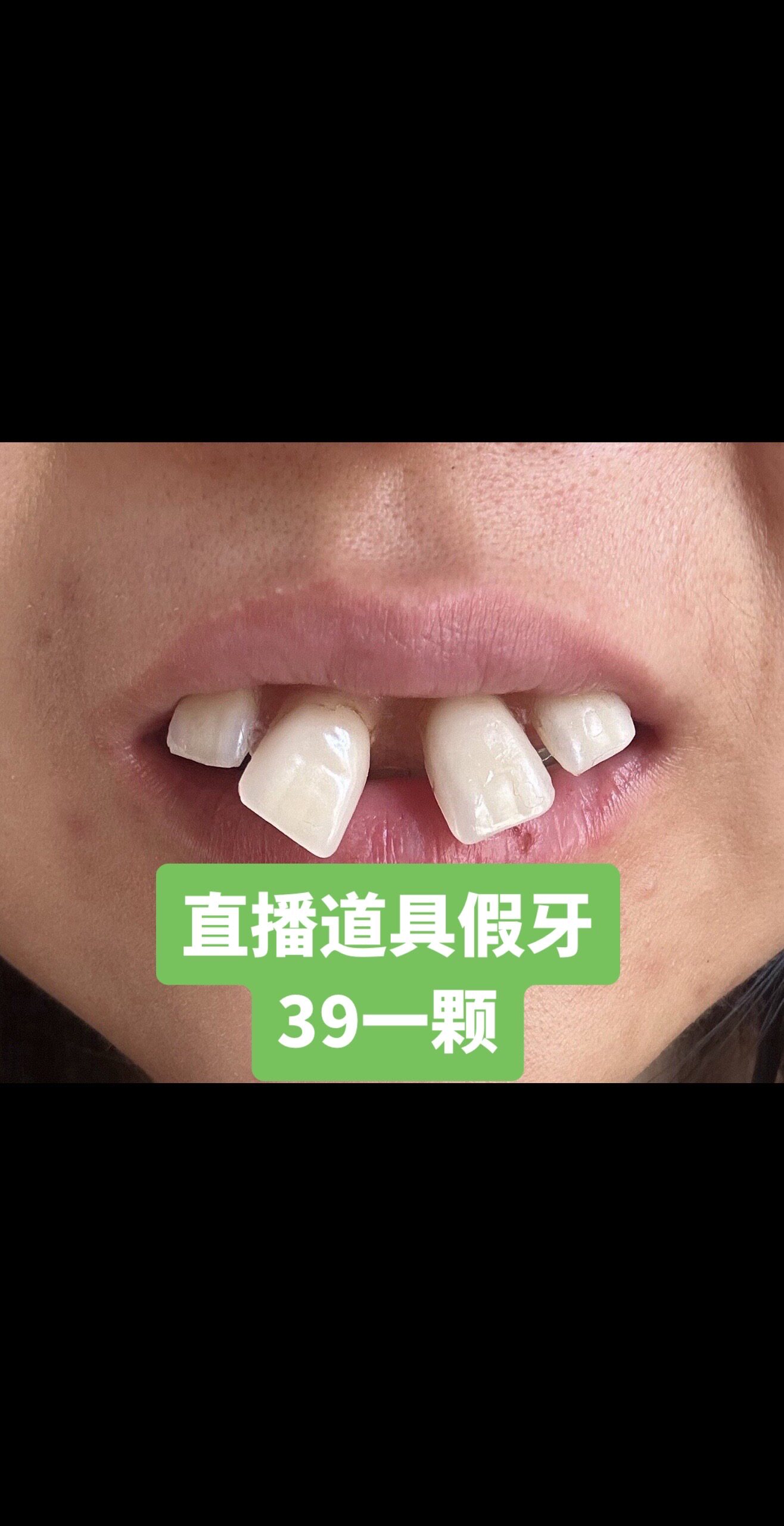 龅牙道具直播假牙道具丑牙道具 引流密码
