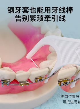 珀俪普正畸矫正专用牙线棒牙签棒牙线盒装成人 家庭儿童通用牙线