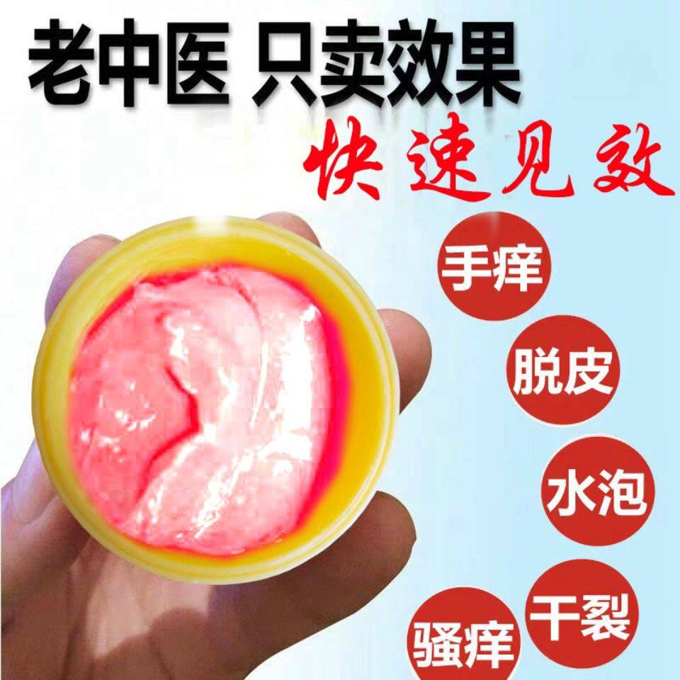 手足湿藓净湿毒红痒止痒脱皮水泡皮肤消毒护理（消）