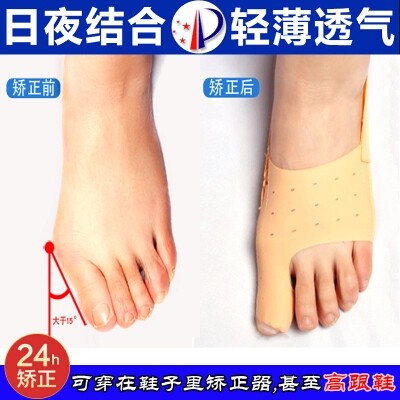 脚趾矫正器拇外翻日夜成人男女姆趾纠正大脚骨儿童拇指外翻矫正器