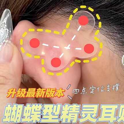 蝴蝶精灵耳贴强支撑升级招风耳神器贴面耳耳朵支撑器隐形