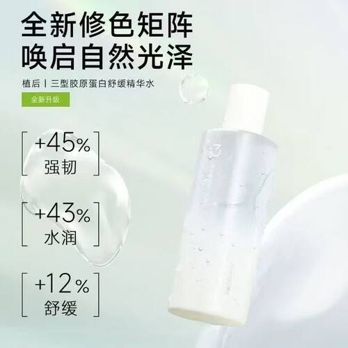 植后芦荟水湿敷水清爽补水控油细致毛孔舒缓改善干燥晒后修护正品
